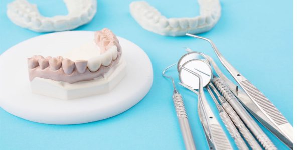 ایمپلنت دندانی و بریج دندان
