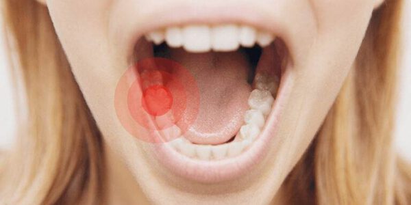 عدم رعایت بهداشت دندان ها