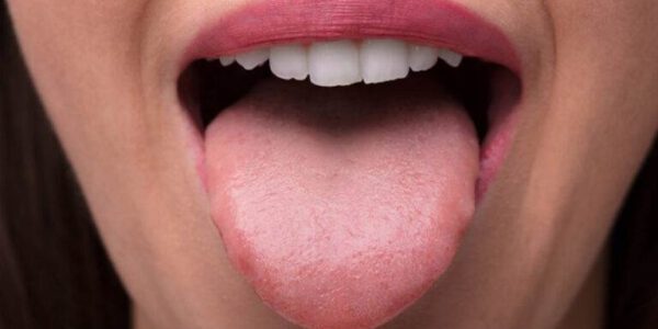 التهاب در زبان