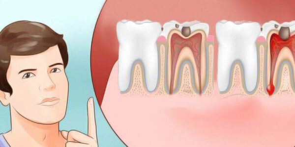 دلیل ایجاد دندان درد
