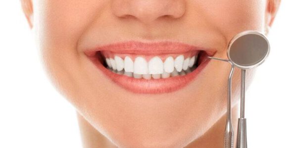 مزیت لمینیت دندان چیست؟