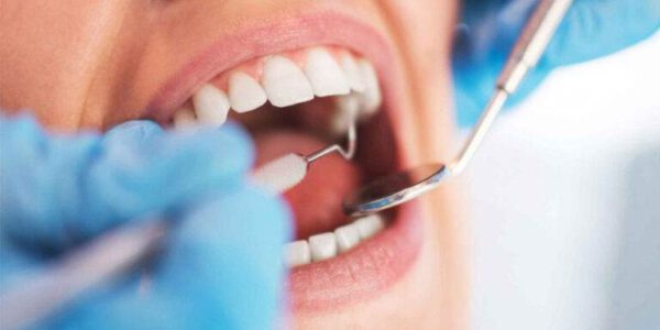 مشکلات و مزایای کامپوزیت دندان