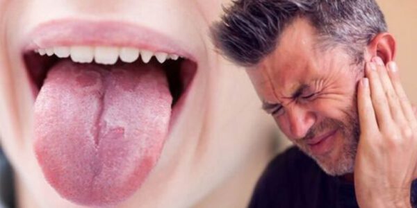 علائم سرطان زبانی