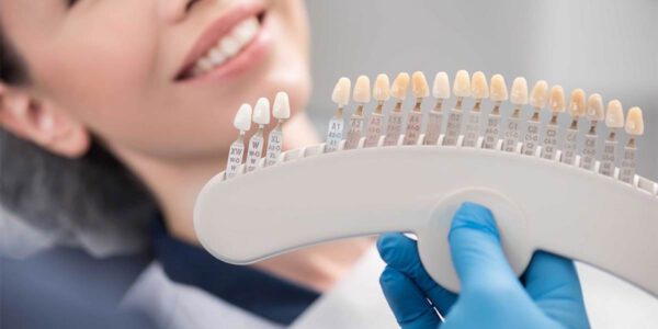 طول عمر کامپوزیت دندان چقدر است