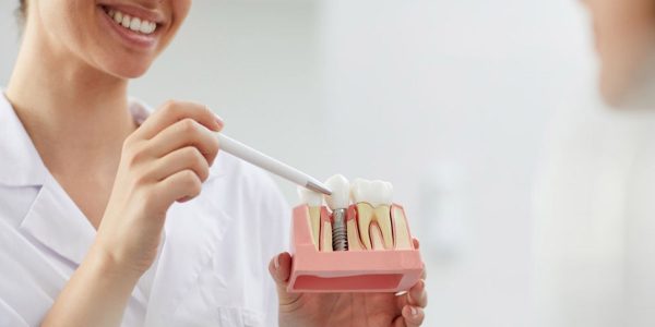 ایمپلنت دندانی مناسب چه کسانی است