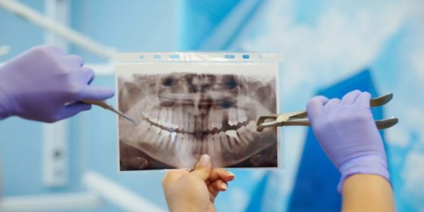 رادیولوژی دندانپزشکی