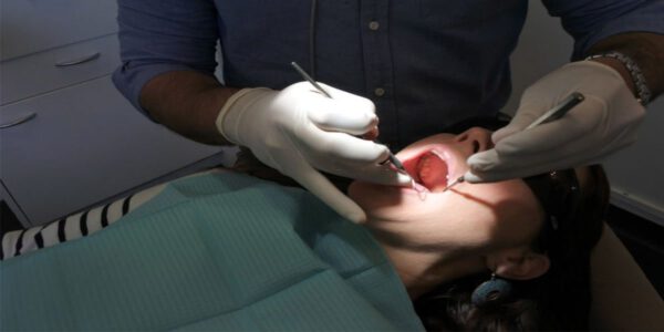 ایمپلنت بلافاصله بعد از کشیدن دندان
