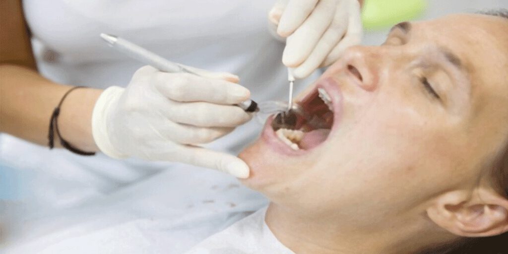 پالپکتومی-دندان
