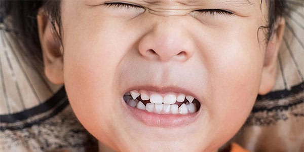 دندان قروچه از مشکلات دهان و دندان اطفال