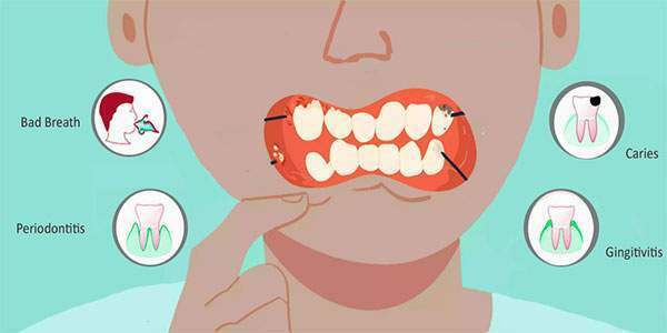 درد ضربان دار دندان - دلایل و نحوه درمان آن - کلینیک دندانپزشکی سبز
