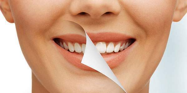 تفاوت بلیچینگ با جرمگیری دندان