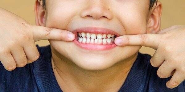 درمان پوسیدگی دندان شیری