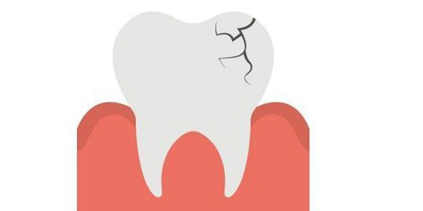 علت ترک دندان