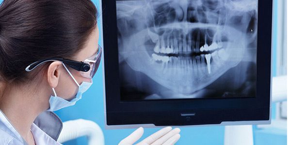 عکس رادیولوژی از دندان