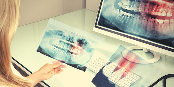 هزینه رادیولوژی دندان
