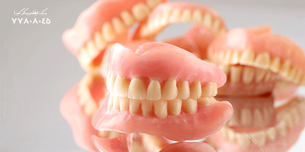 تفاوت دندان مصنوعی ثابت و متحرک
