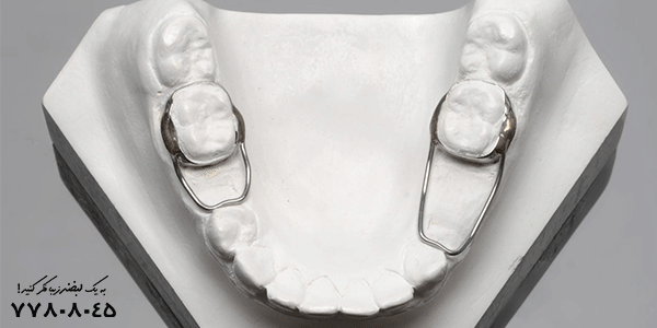 فضانگهدارنده ثابت دندان کودکان