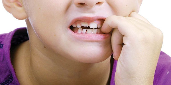 علت لق شدن دندان دائمی کودکان