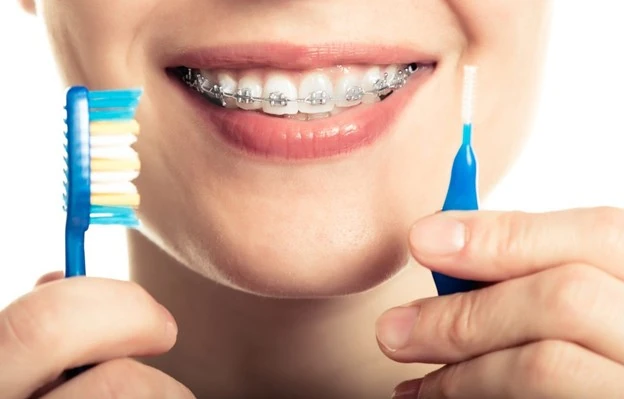 سلامت دندان در لق شدن بعد از ارتودنسی