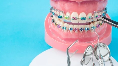 لق شدن دندان‌ها بعد از درمان ارتودنسی