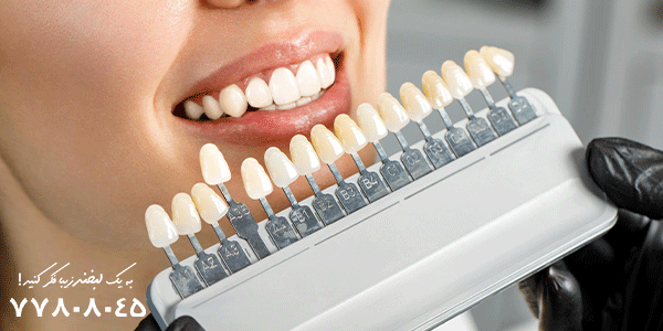 لمینیت دندان بهتر است یا ارتودنسی 