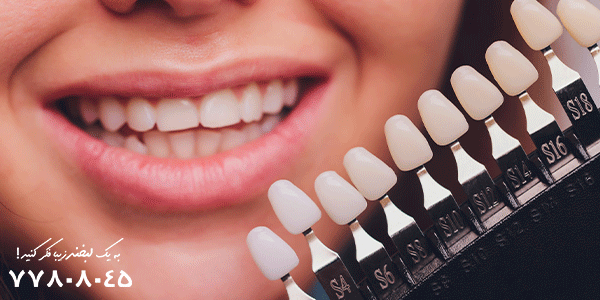 لمینیت دندان بهتر است یا ارتودنسی