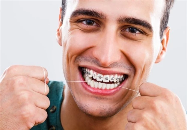 مراقبت های لازم بعد از ارتودنسی و لق شدن دندان