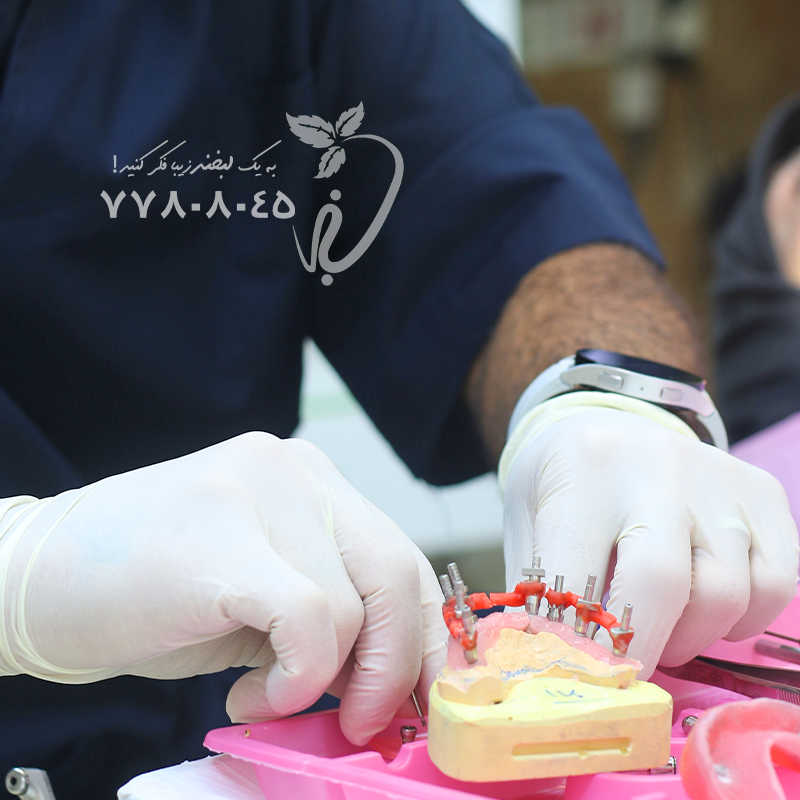 متخصص پروتز‌های دندانی در تهرانپارس